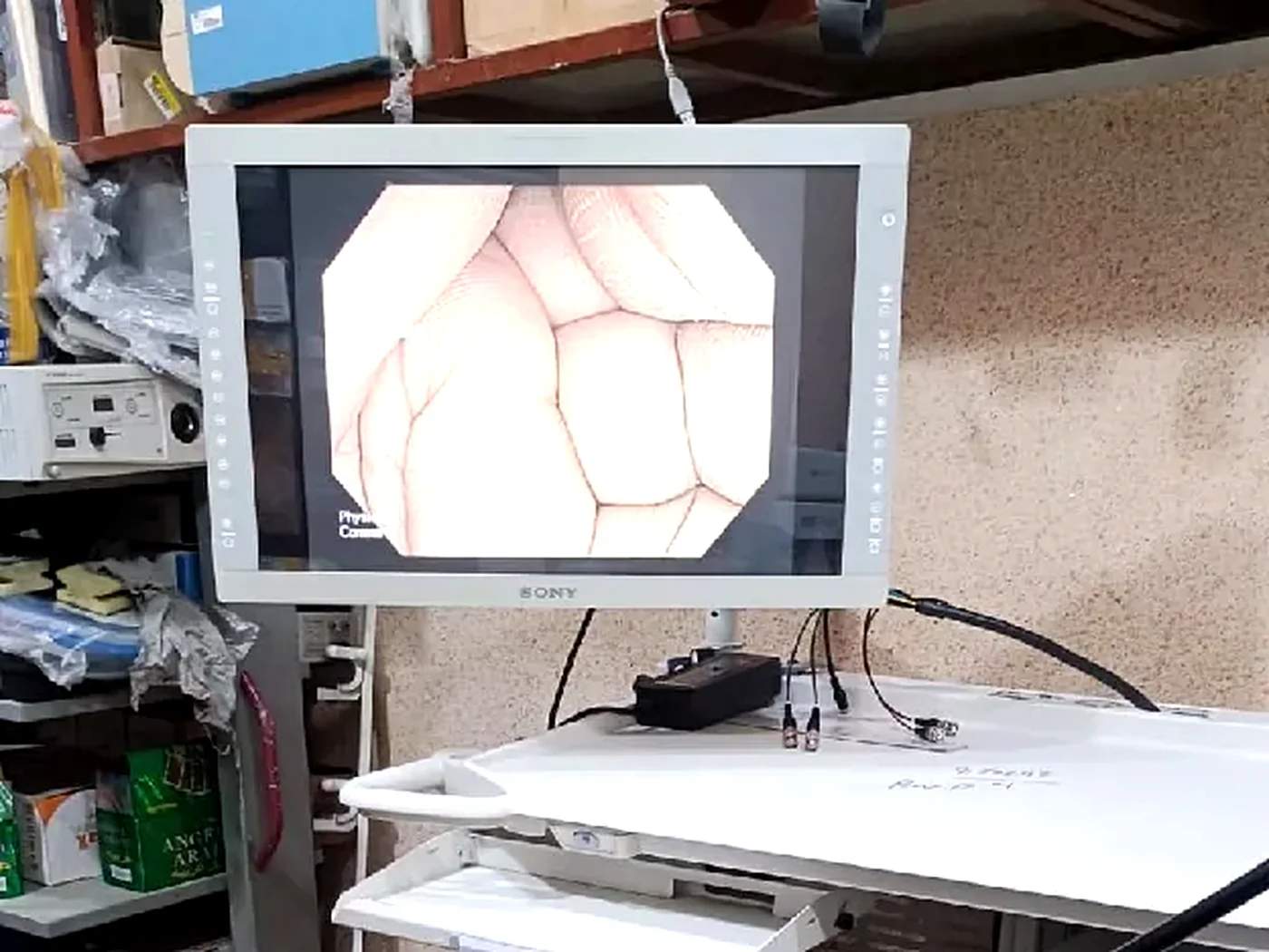 Lahore Endoscopy Center — Olympus endoscopy tower with live colonoscopy view in our procedure suite